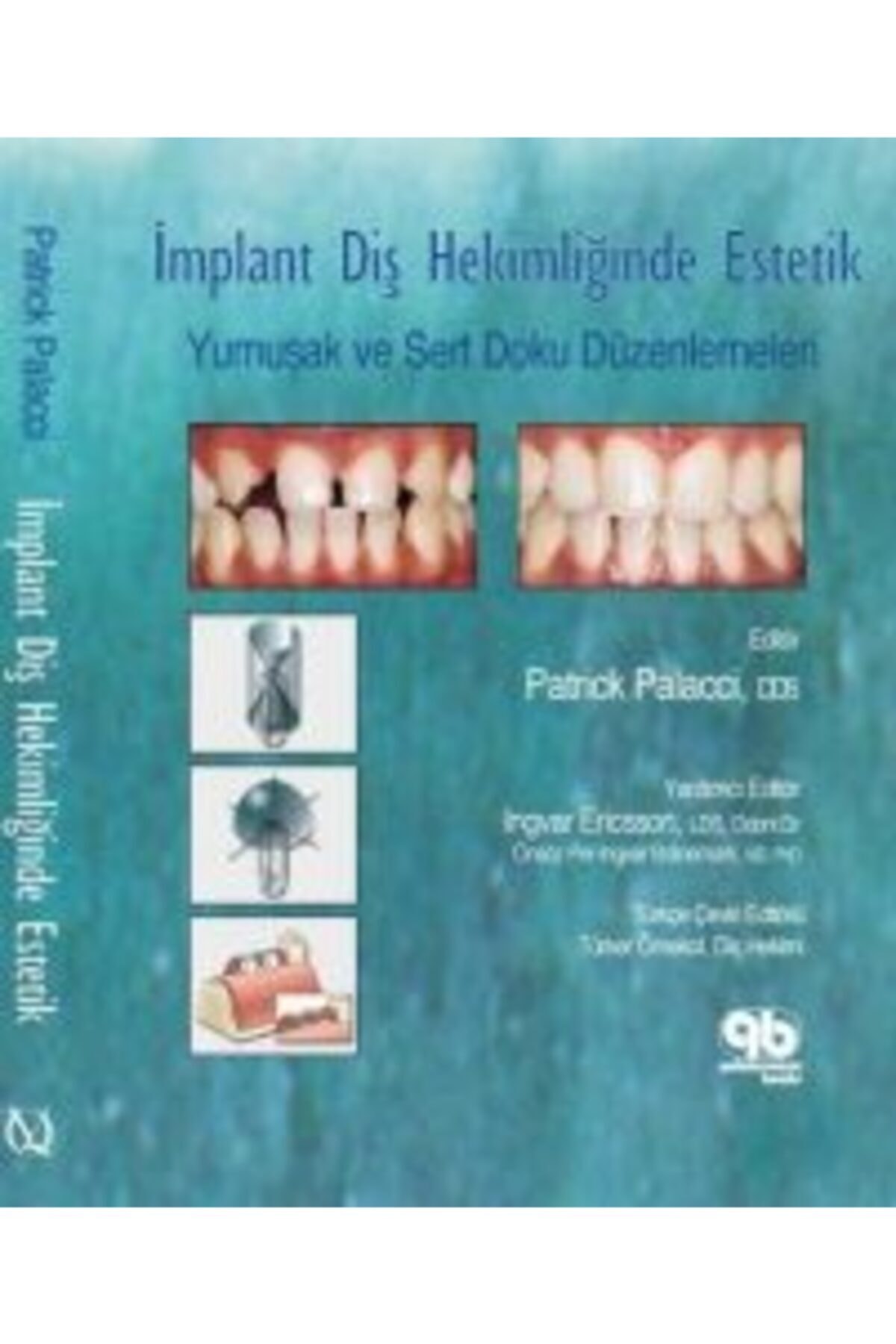 Anadolu Nobel Tıp Kitabevleri Implant Diş Hekimliğinde Estetik