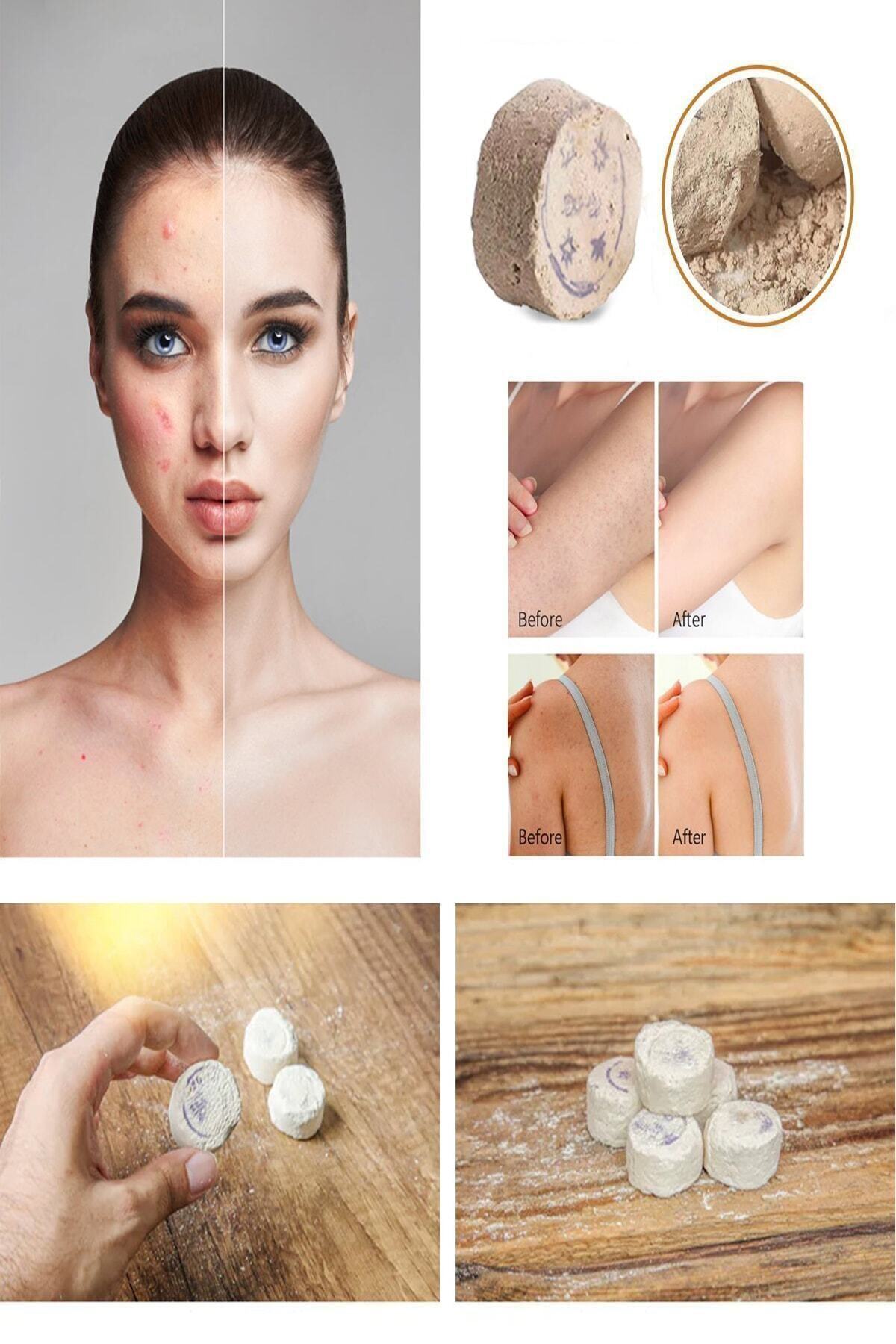 Peeling Market Orjinal Mühürlü Iran Üretimi Peeling Taşı 12 Adet