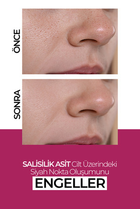 Nemlendirici Cilt Yenileyici Leke Karşıtı Krem 50ML Image 2