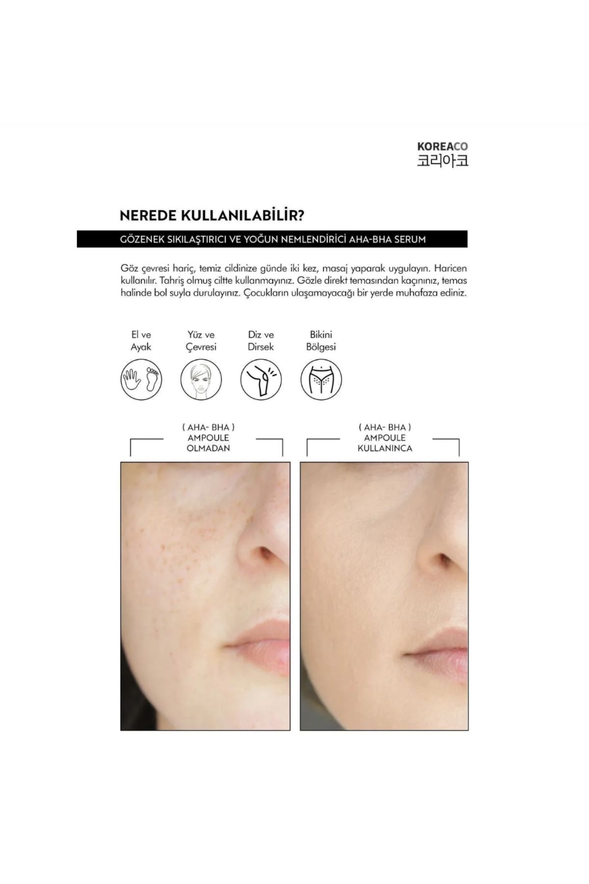 KoreaCo Aha & Bha Canlandırıcı & Gözenek Sıkılaştırıcı Ve Nemlendirici (AHA%10-BHA%2) Serum