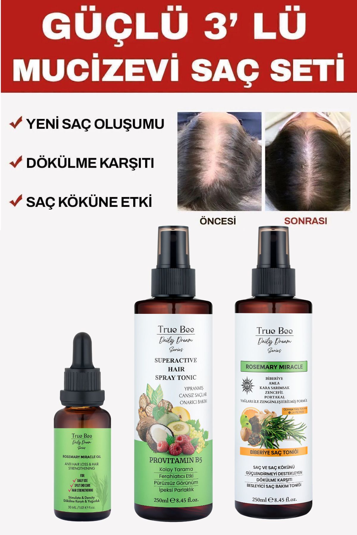 Daily Dream Care Güçlü 3’Lü Mucizevi Saç Seti Biberiye Tonik+Sirkeli Tonik + Biberiye Kompleks Yağ