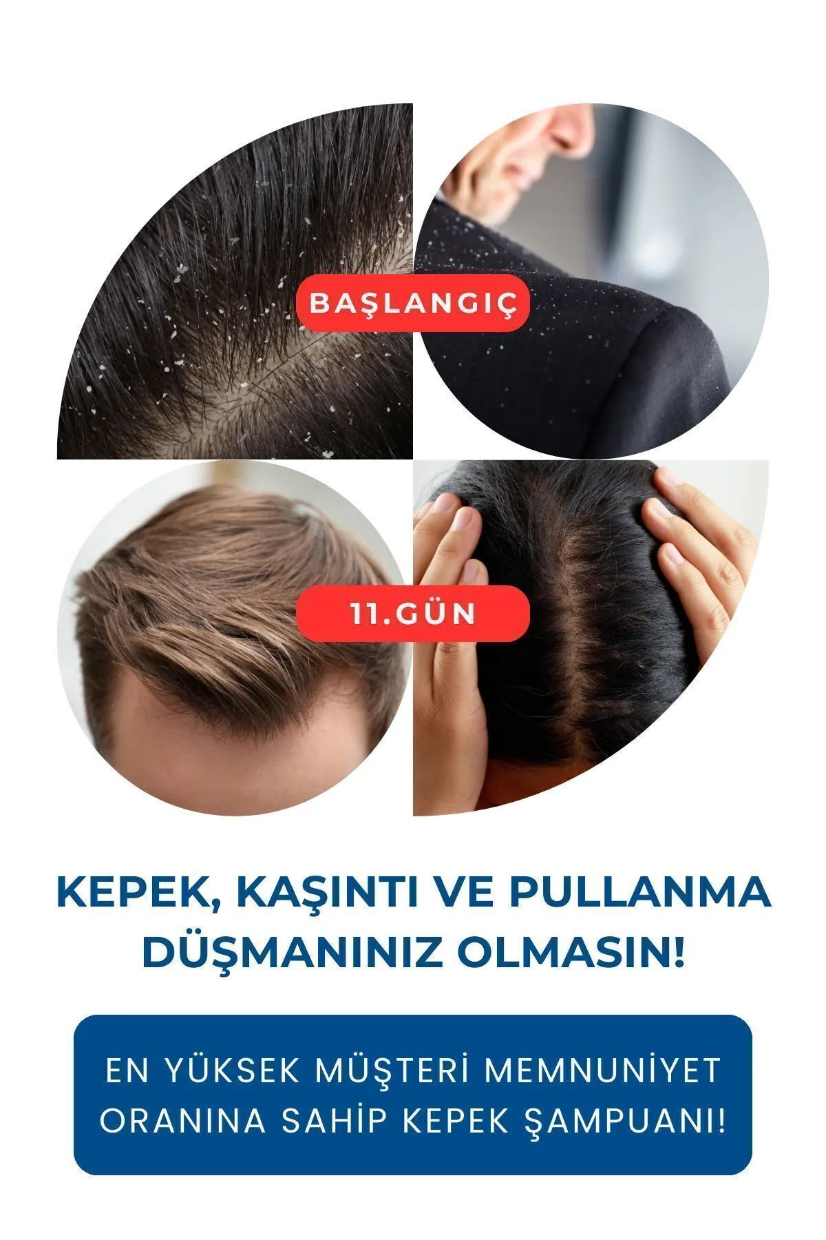 Relief 2'li Devam Seti Relief Devam Şampuanı Ve Su Bazlı Losyon