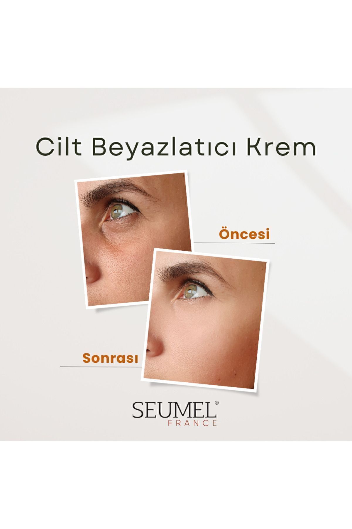 Leke Karşıtı Cilt Beyazlatıcı Krem Vücut, Yüz, Koltuk Altı, Genital Bölge 200 ml