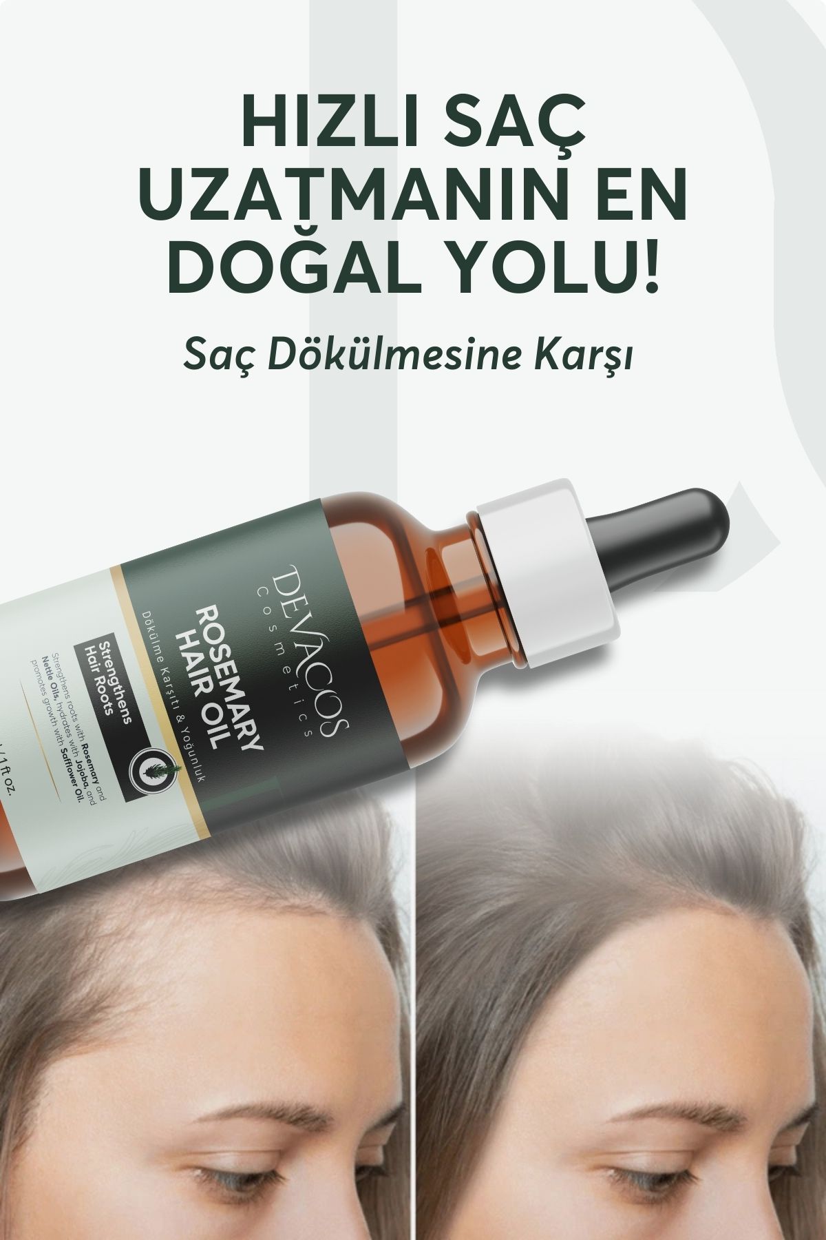 Biberiye Maya Yağı Komplexi Saç Dökülmesi Ve Yıpranmış Saçlar Hızlı Saç Sakal Uzatan Biotinli Yağ3