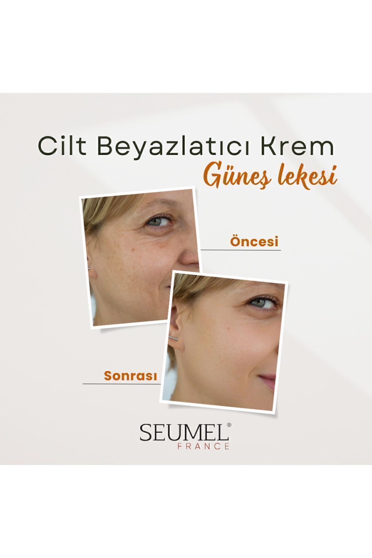 Leke Karşıtı Cilt Beyazlatıcı Krem Vücut, Yüz, Koltuk Altı, Genital Bölge 200 ml