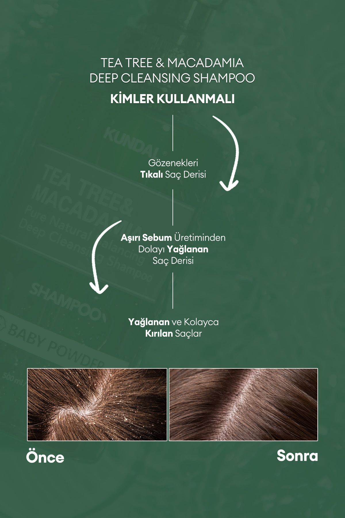 Sorunlu Saç Derisine Özel Şampuan Tea Tree & Macadamia Deep Cleansing Shampoo (BABY POWDER)