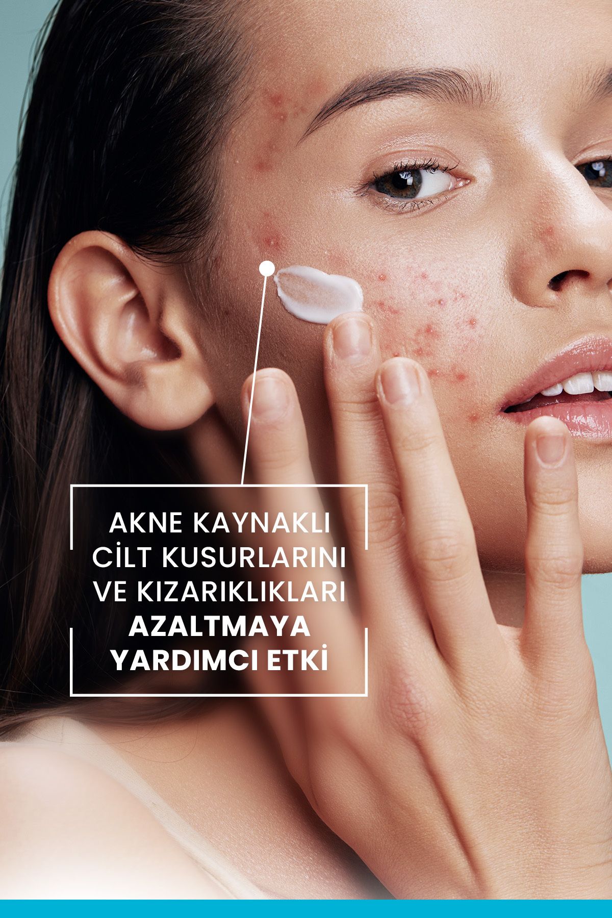 Keracnyl PP+ Akneye Eğilimli Ciltler İçin Cilt Kusurlarını Azaltmaya Yardımcı Bakım Kremi 30 ml