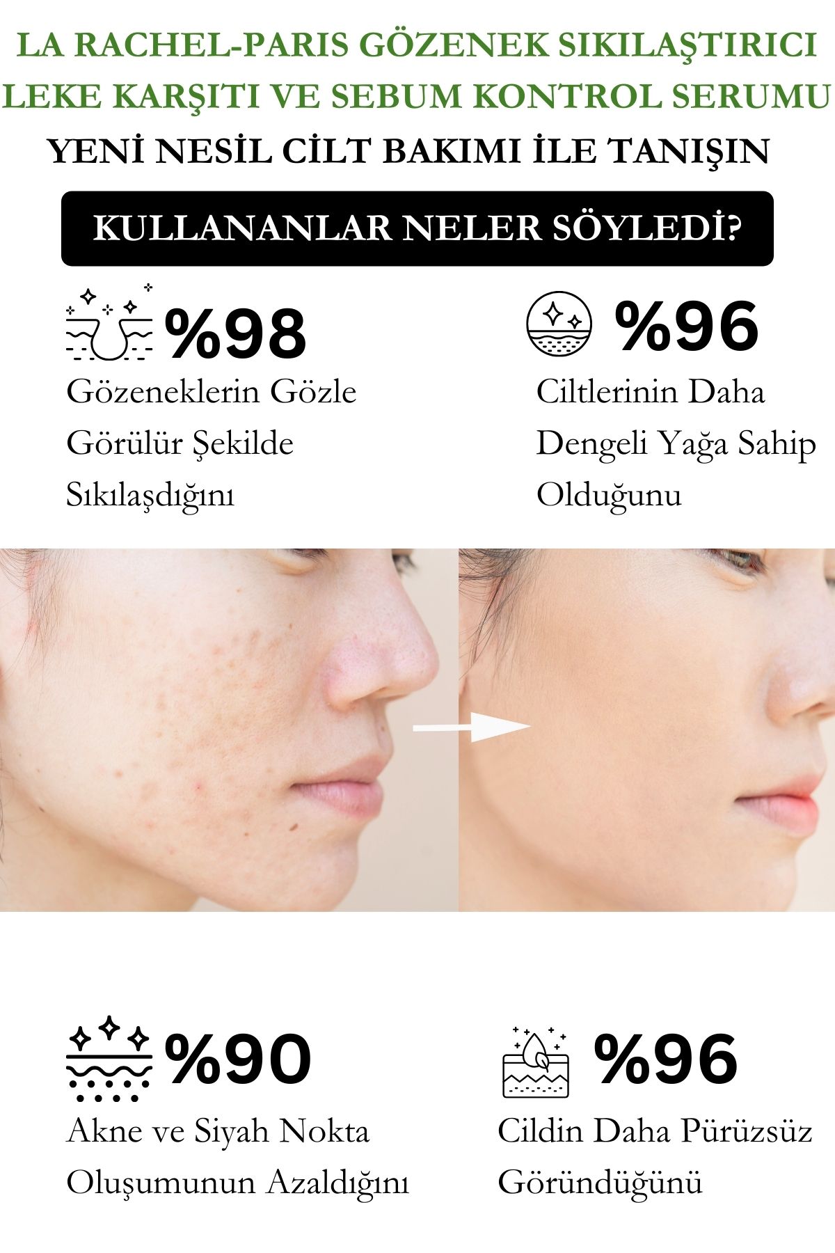 Profesyonel Güçlü Gözenek Sıkılaştırma ve Akne Karşıtı-1 Serum 4 Etki-Gözenek, Akne, Yenileme, Sebum