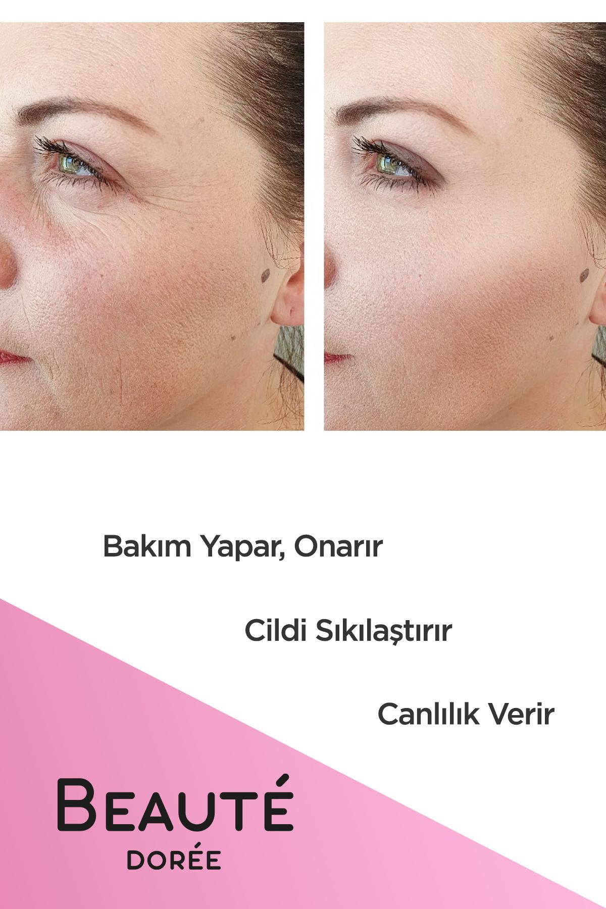 Anti - Aging Gençleştirici Yaşlanma Karşıtı Ve Kırışıklık Karşıtı Krem 50 ml