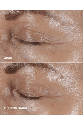 Smart Clinical Repair™ Çizgi Ve Kırışıklık Görünümü Karşıtı Göz Kremi 15ml | Hyalüronik Asit, Peptit Image 4