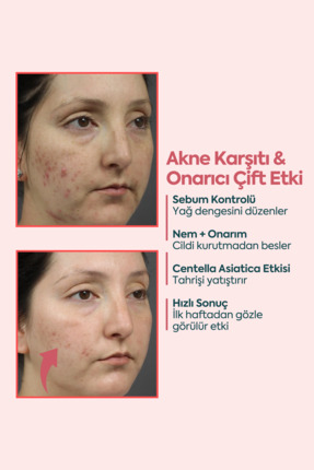 Face Up Skin Kremi, Izi Ve 40ml Image 3