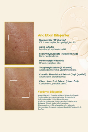 Face Up Skin Aydınlatıcı Leke Kremi, Leke Karşıtı, Siyah Nokta 40ml Image 7