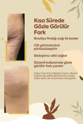 Anında Sıkılaştırıcı Ve Selülit Önleyici Krem (ANTİ-CELLULİTE CREAM) Image 5