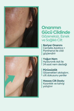 Face Up Skin Gözenek Sıkılaştırıcı, Onarıcı, Kırışıklık Karşıtı Cilt Kremi 40ml Image 3