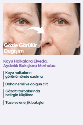 Face Up Skin Göz Altı Kremi, Göz Altı Morlukları Ve Göz Altı Nemlendirici 40ml Image 4