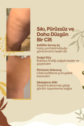 Anında Sıkılaştırıcı Ve Selülit Önleyici Krem (ANTİ-CELLULİTE CREAM) Image 3