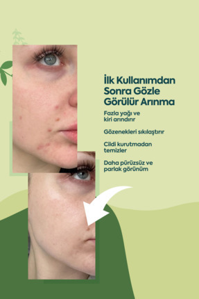 Kil Maskesi, Gözenek Sıkılaştırıcı, Leke Karşıtı, Nemlendirici Image 5