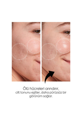 Aydınlatıcı Leke Karşıtı ve Gözenek Karşıtı Toner Bir Arada 200+200 M Image 2