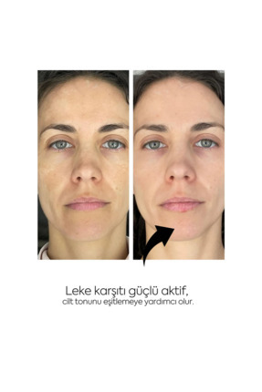 Aydınlatıcı Leke Karşıtı ve Gözenek Karşıtı Toner Bir Arada 200+200 M Image 4