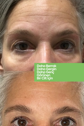 Aloevera Gel Mask - Gençleştirici Jel Maske Image 5