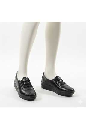 Kadın Siyah Klasik Ayakkabı Ortopedik Anne Ayakkabısı Anne Babet Ayakkabı Anne Kadın Günlük Image 0