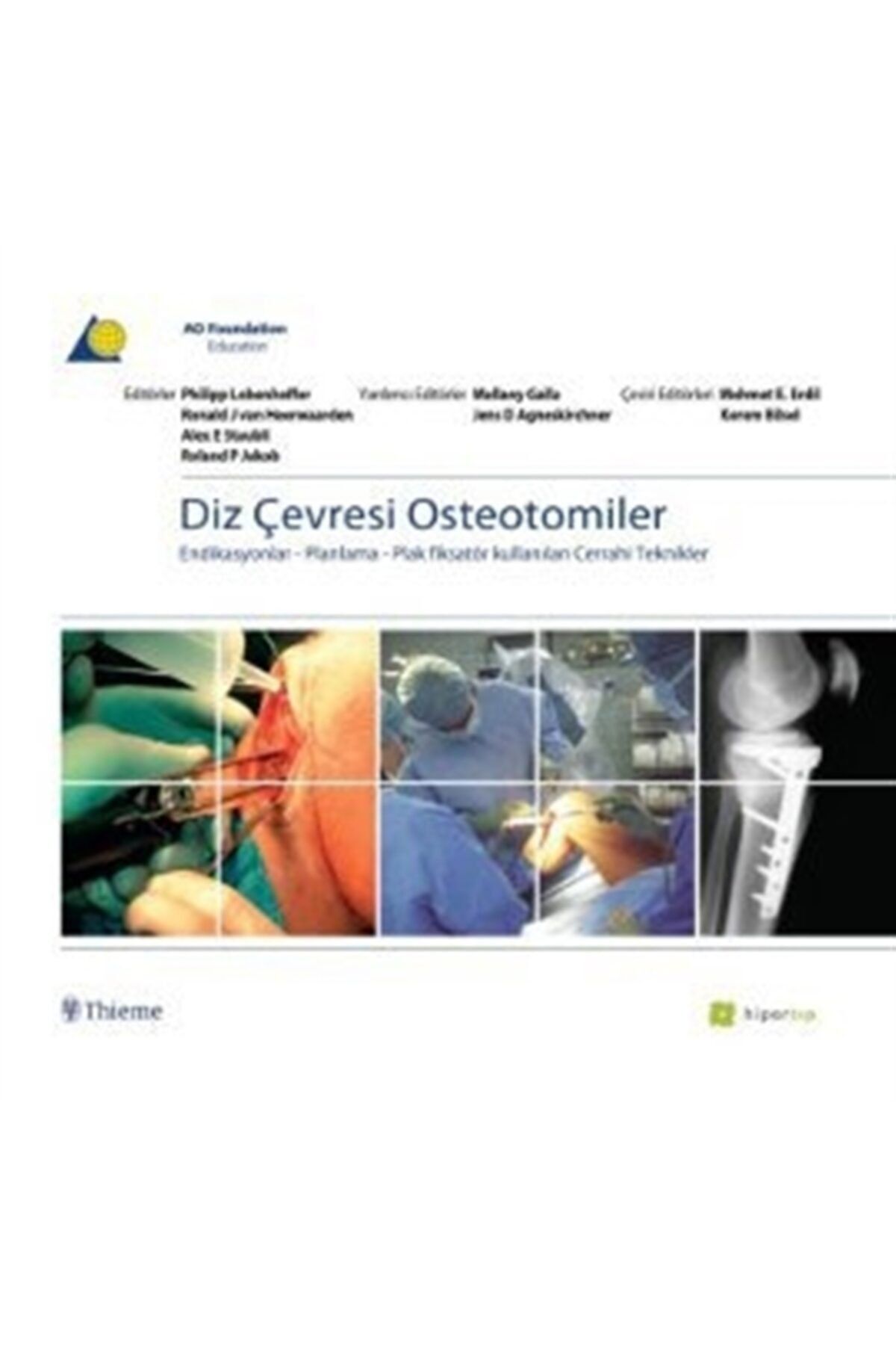 Hiper Tıp Diz Çevresi Osteotomiler