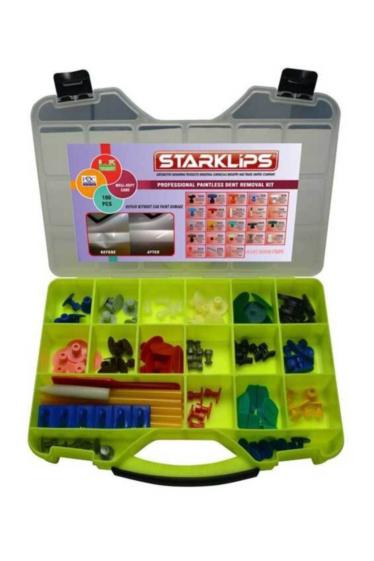 Star Klips Boyasız Göçük Düzeltme Set Çanta 17x5 100 Parça