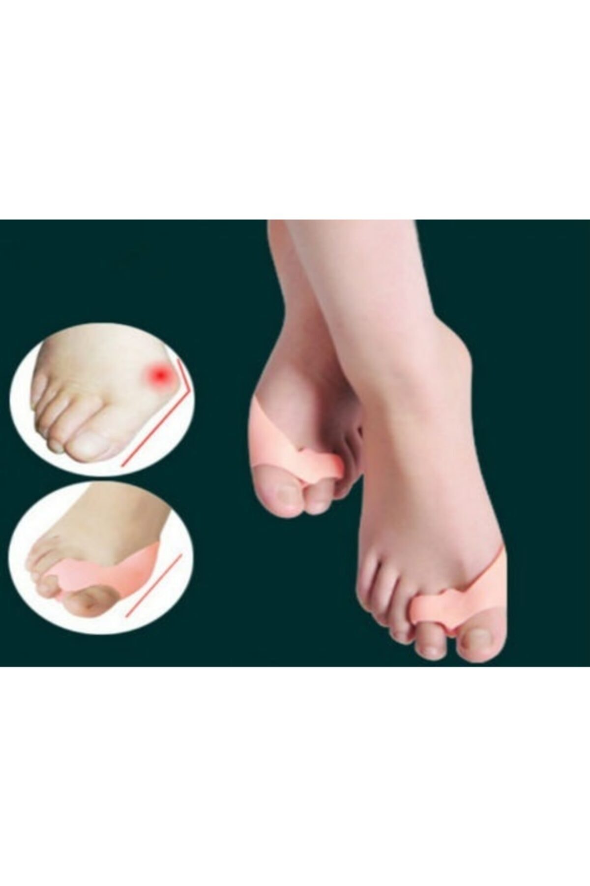 rennway Ayak Bunyon Koruyucu 2 Parmağa Geçen Makaralı Set Ten Rengi