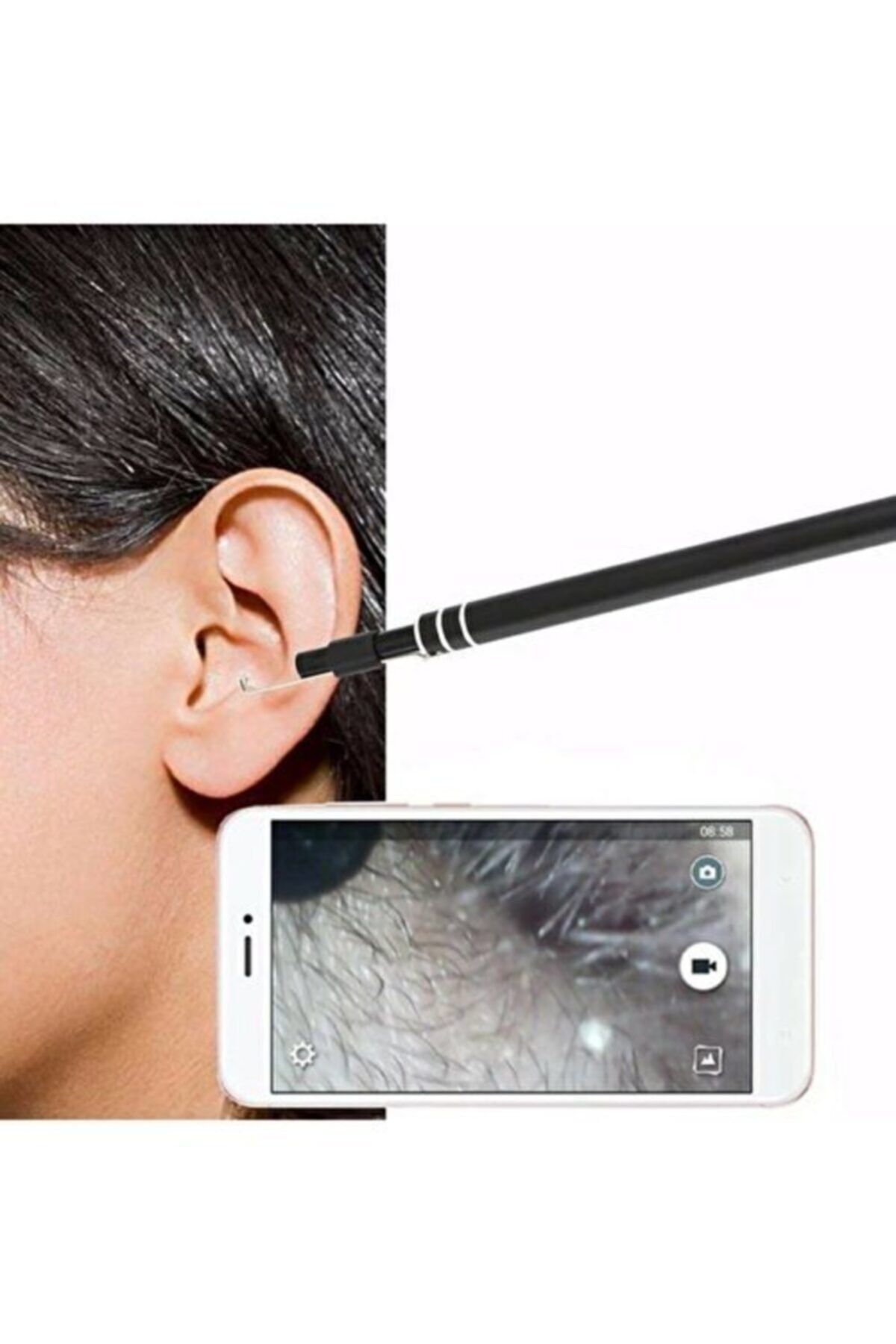 abenim Otoscope Kamera Kulak Içi Görüntüleme Ve Temizleme Kamerası