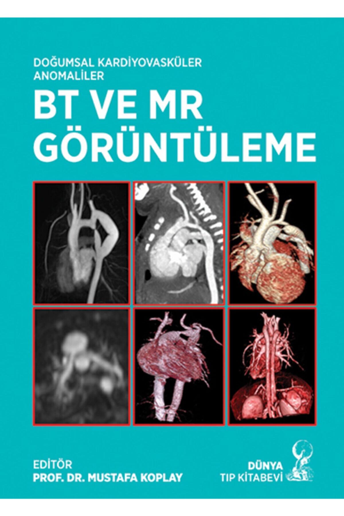 Dünya Tıp Kitabevi Doğumsal Kardiyovasküler Anomaliler Bt Ve Mr Görüntüleme