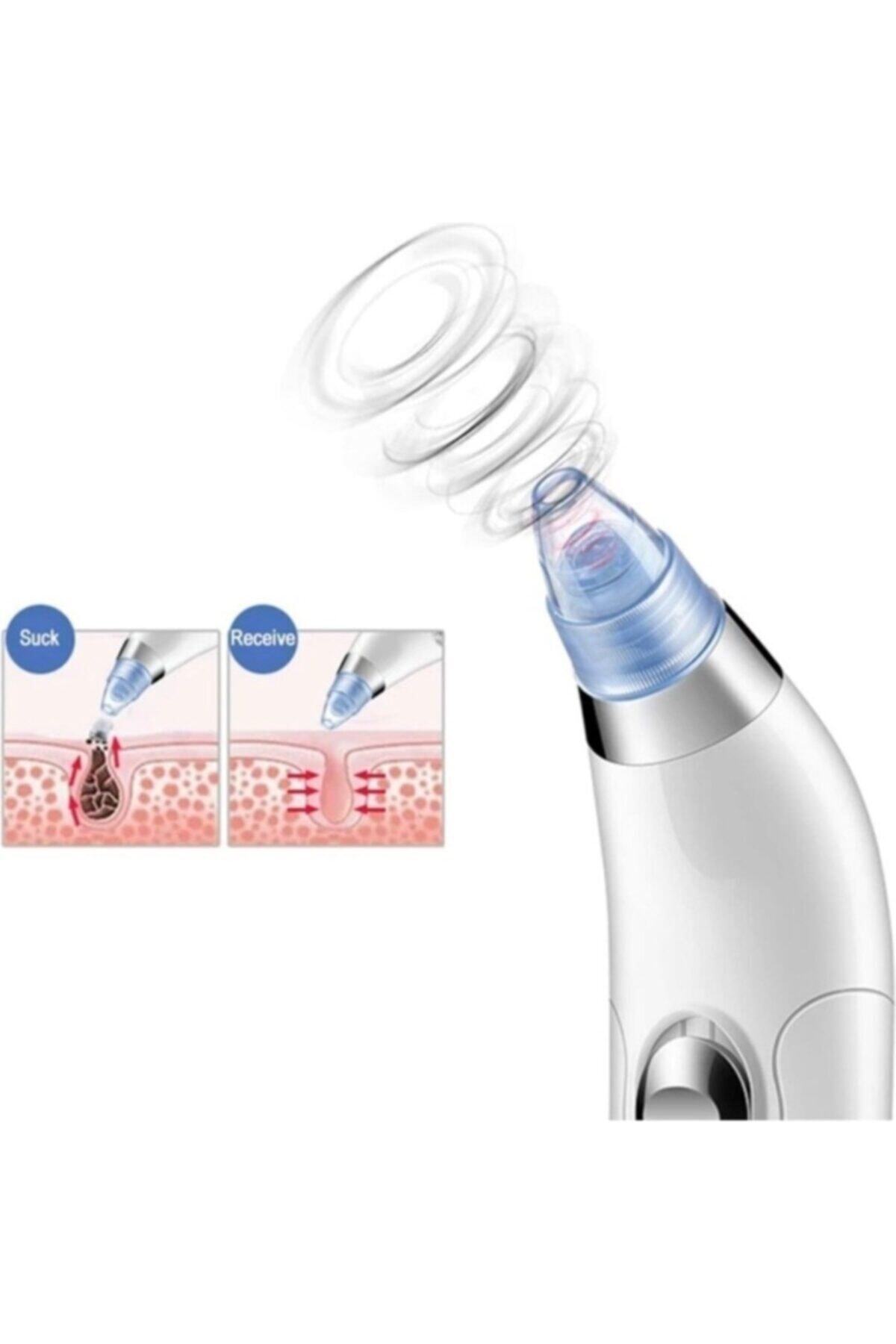 Firsat Ayi Pazarız Profesyonel Vakumlu Yüz Temizleyici Siyah Nokta Akne Peeling