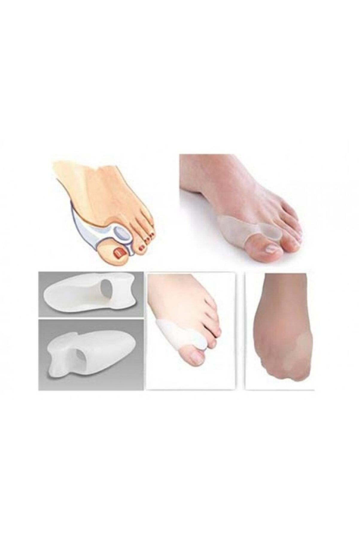 iHealt Parmak Arası Makaralı Bunion Koruyucu (hallux Valgus)