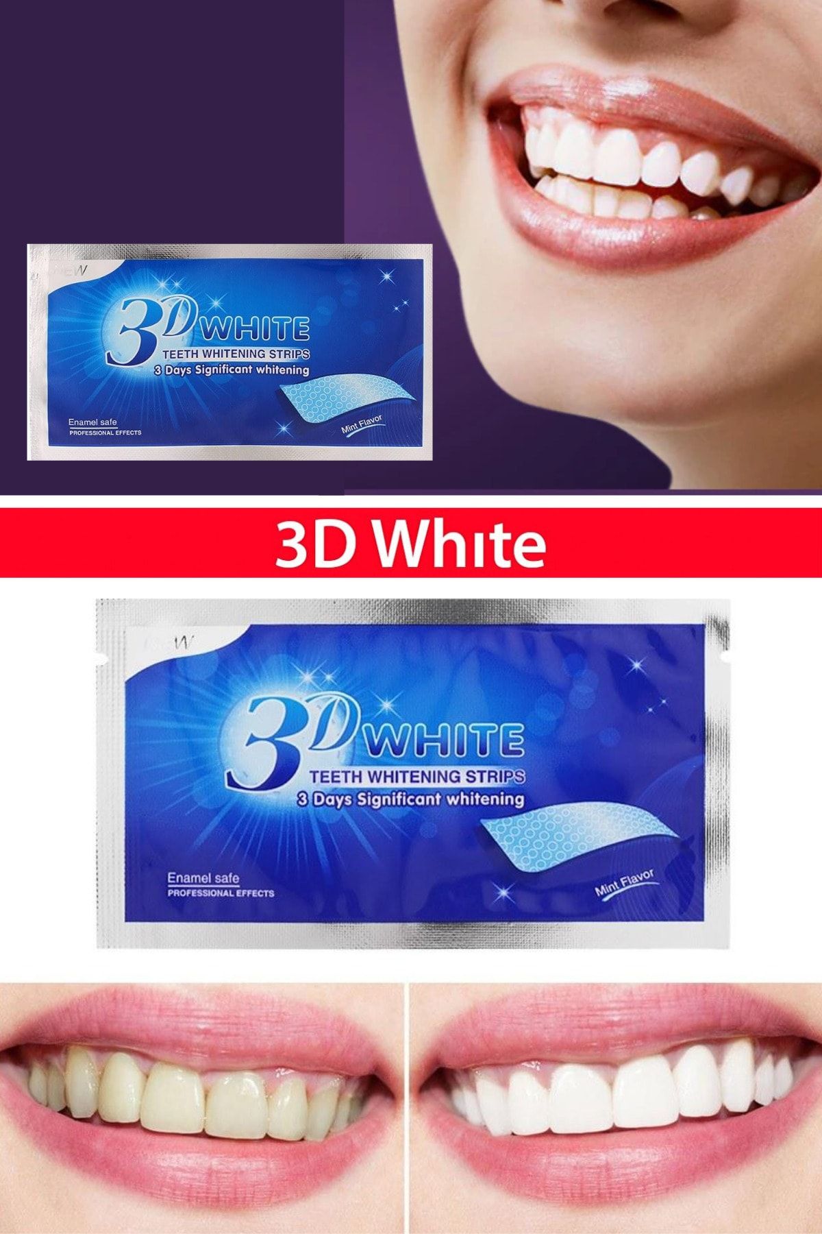 QNİAY Diş Beyazlatma Bandı ( 5 Adet) 3d White Professional Diş Beyazlatma Bantları Diş Bakımı