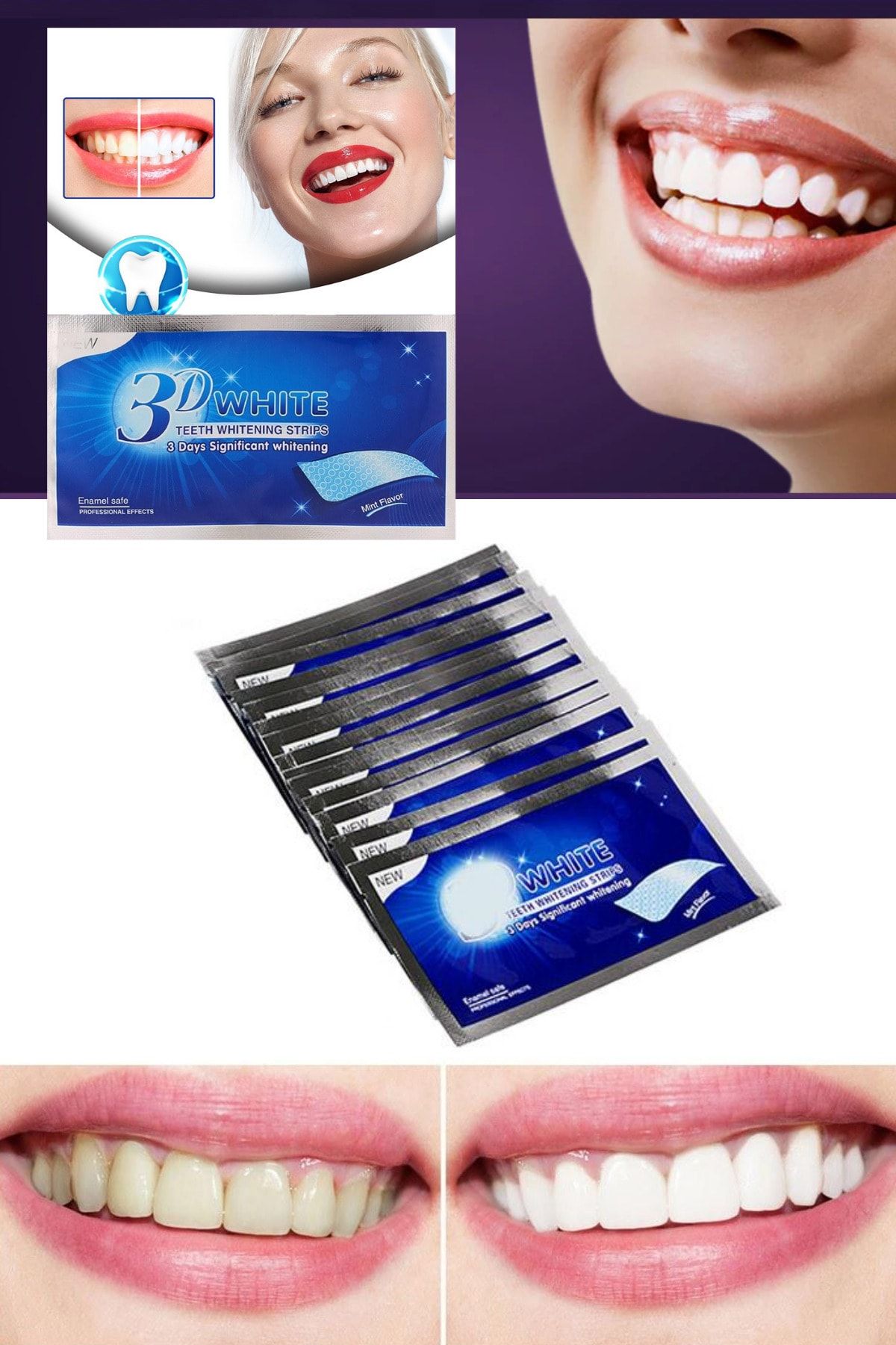 QNİAY 3d White Professional Diş Beyazlatma Bantları Diş Beyazlatma Bandı ( 5 Adet) Diş Bakımı Bandı