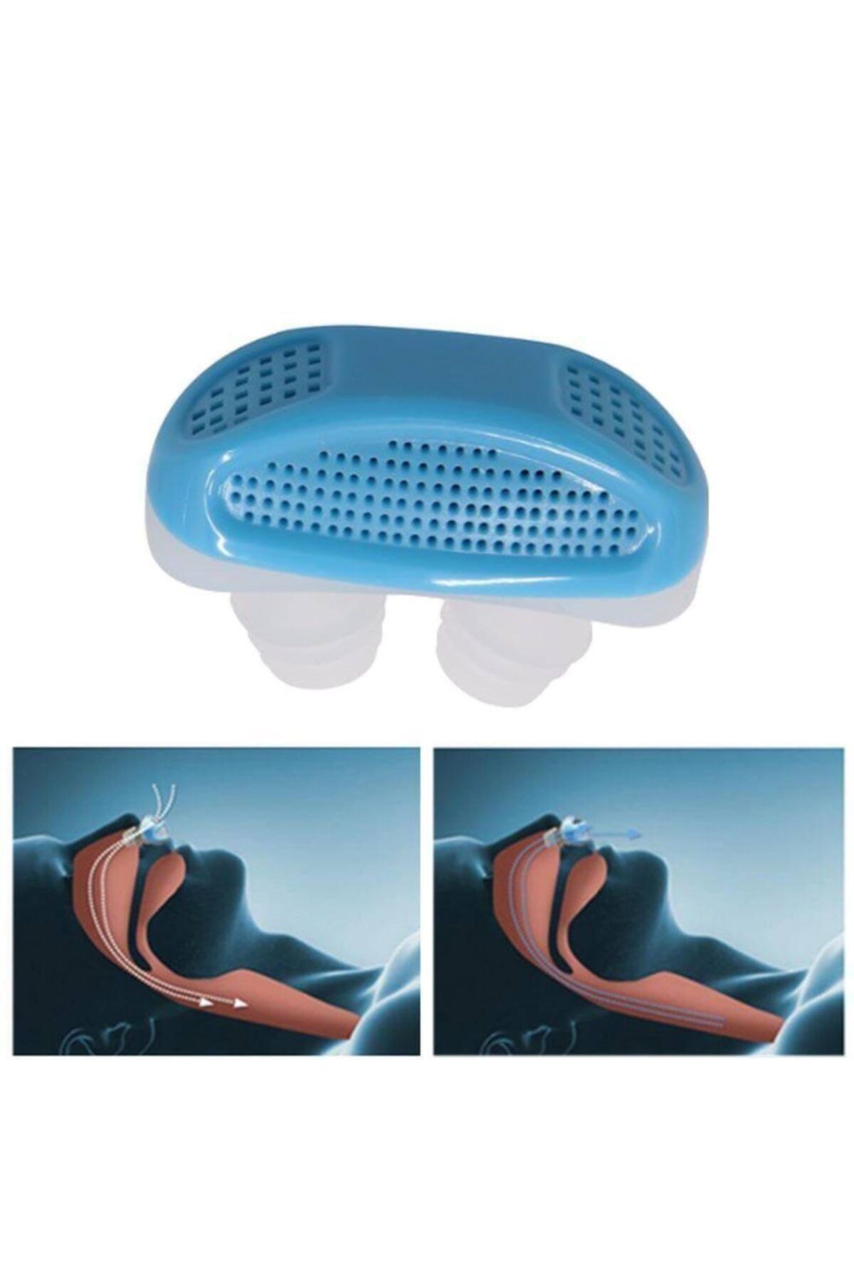 HİLALSHOP 1 Adet Horlama Azaltıcı Burun Aparatı 1 Adet Kafa Bandı Seti