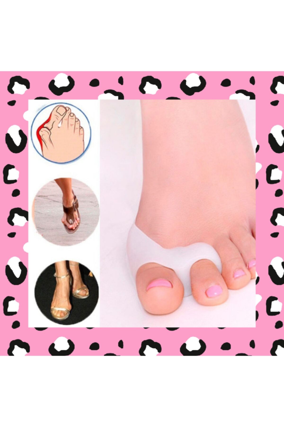 BEAUTY BOX COSMETIC Halluks Valgus Ağrısına Karşı Etkili Ayak Baş Parmak Düzeltici Ortopedik Aparat