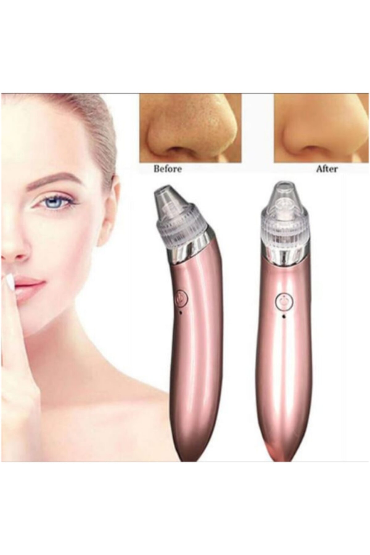 Mire's Collection Siyah Nokta Akne Cilt Temizleme Aleti