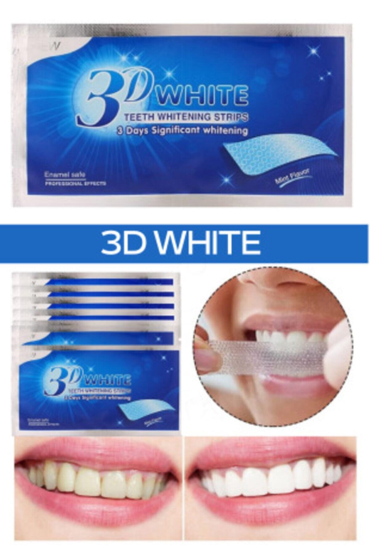 QNİAY 3d White Professional Diş Beyazlatma Bantları Diş Beyazlatma Bandı ( 10 Adet) Diş Bakımı