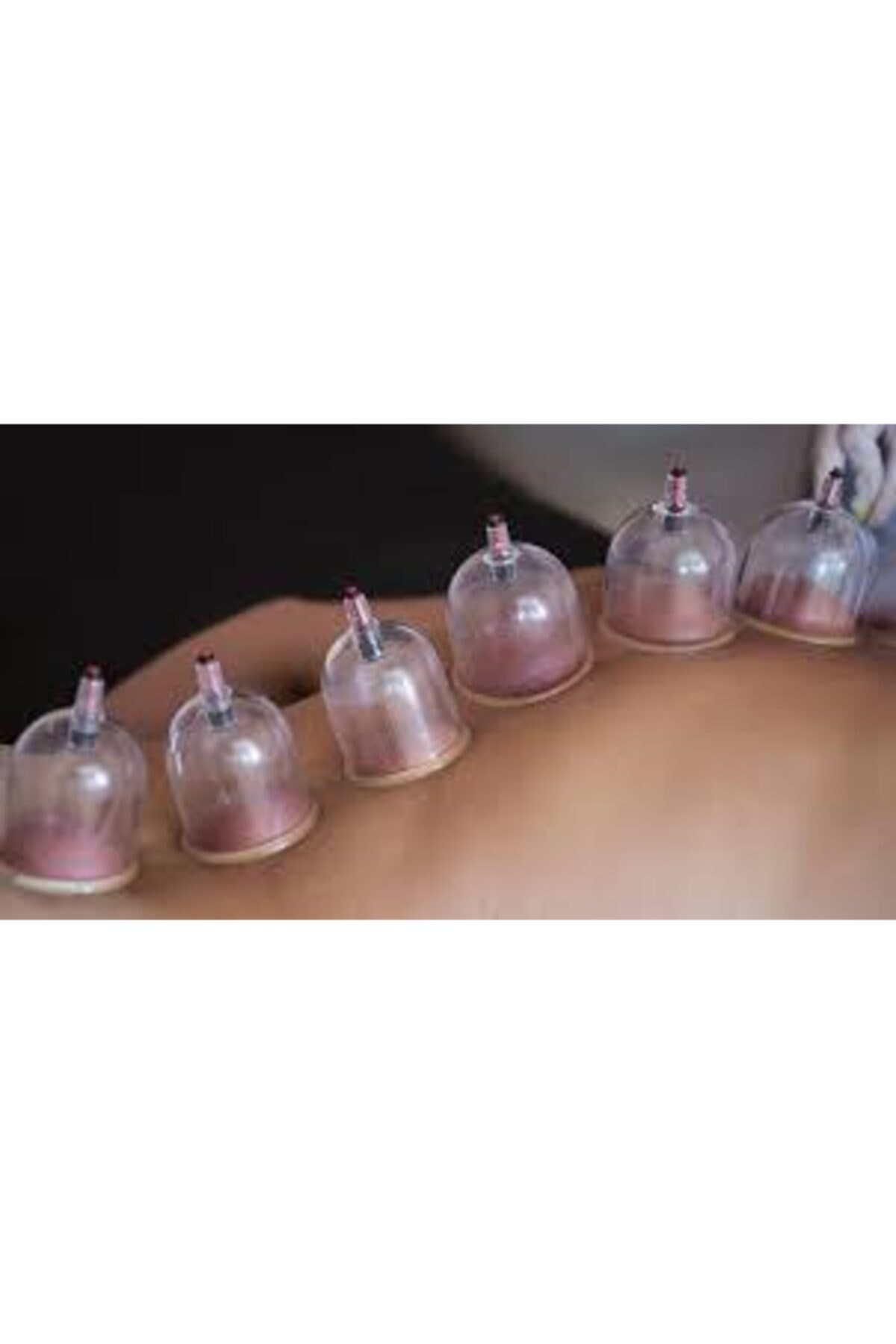 HACAMAX Hacamat Kupası 5 Cm '' Toptan'' 100 Adet 1.kalite Pompa Hediyeli