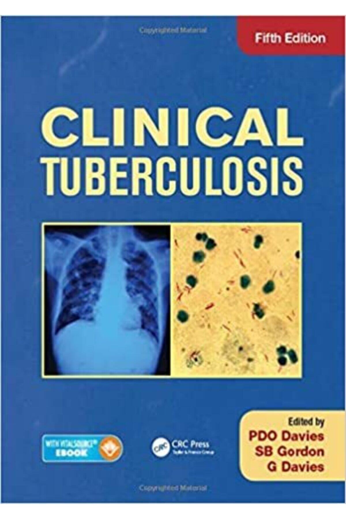 Crc Clinical Tuberculosis (English) 5th Edition