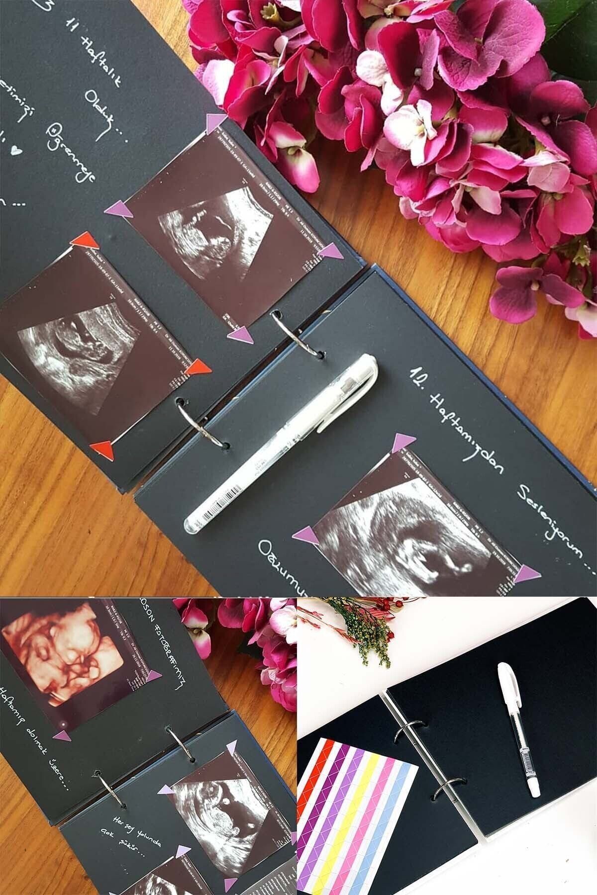 Chenar Gift&Design Kaktüs Tasarımlı Fotoğraf Albümü Anı Defteri