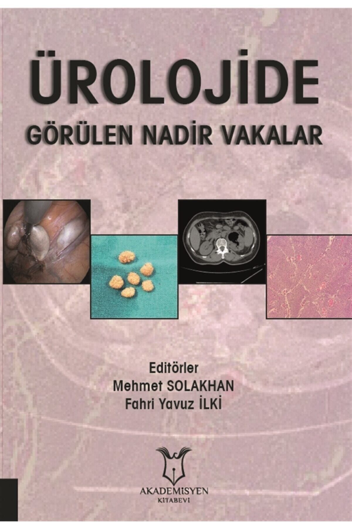 Akademisyen Kitabevi Ürolojide Görülen Nadir Vakalar