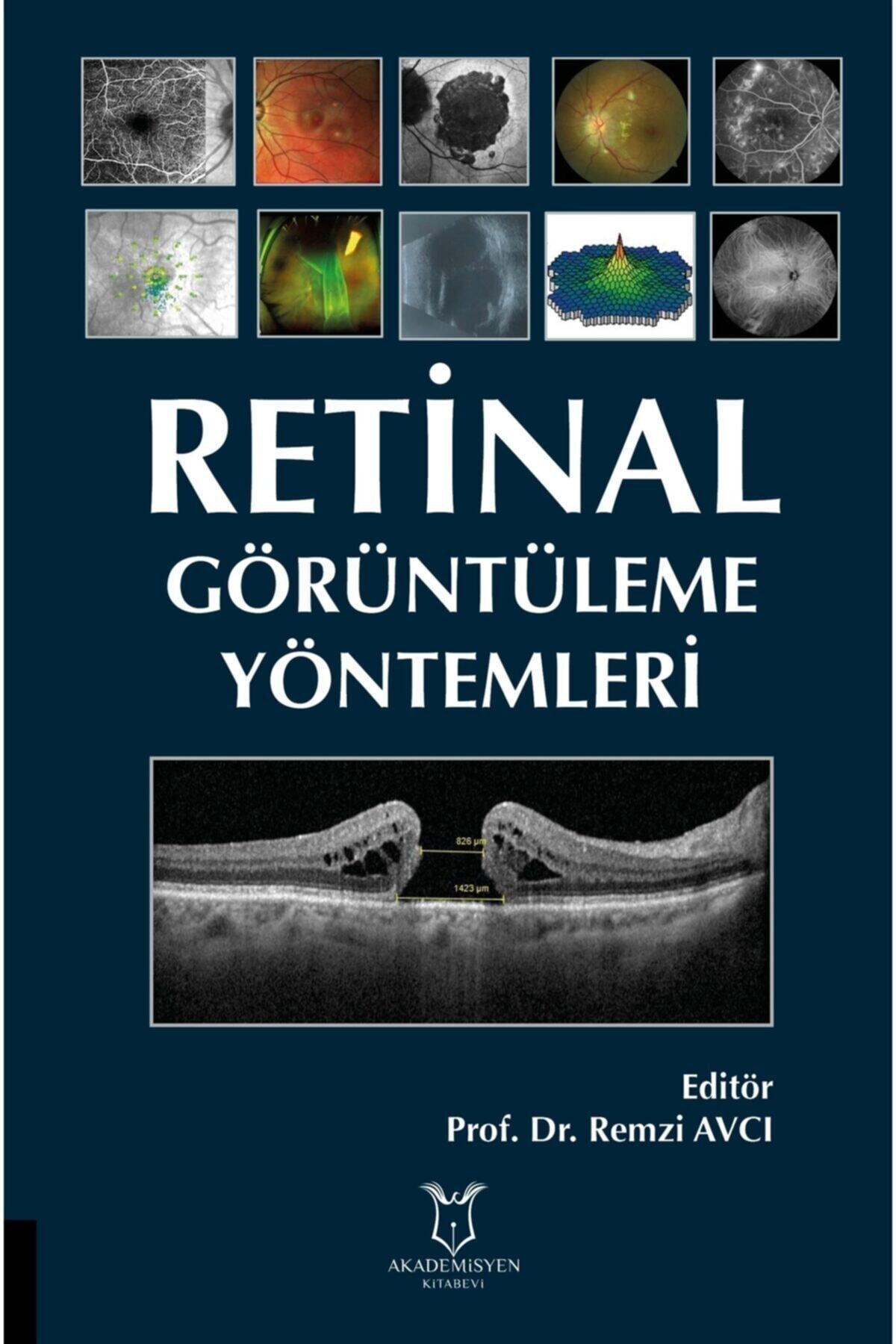 Akademisyen Kitabevi Retinal Görüntüleme Yöntemleri - Remzi Avcı 9786257354424