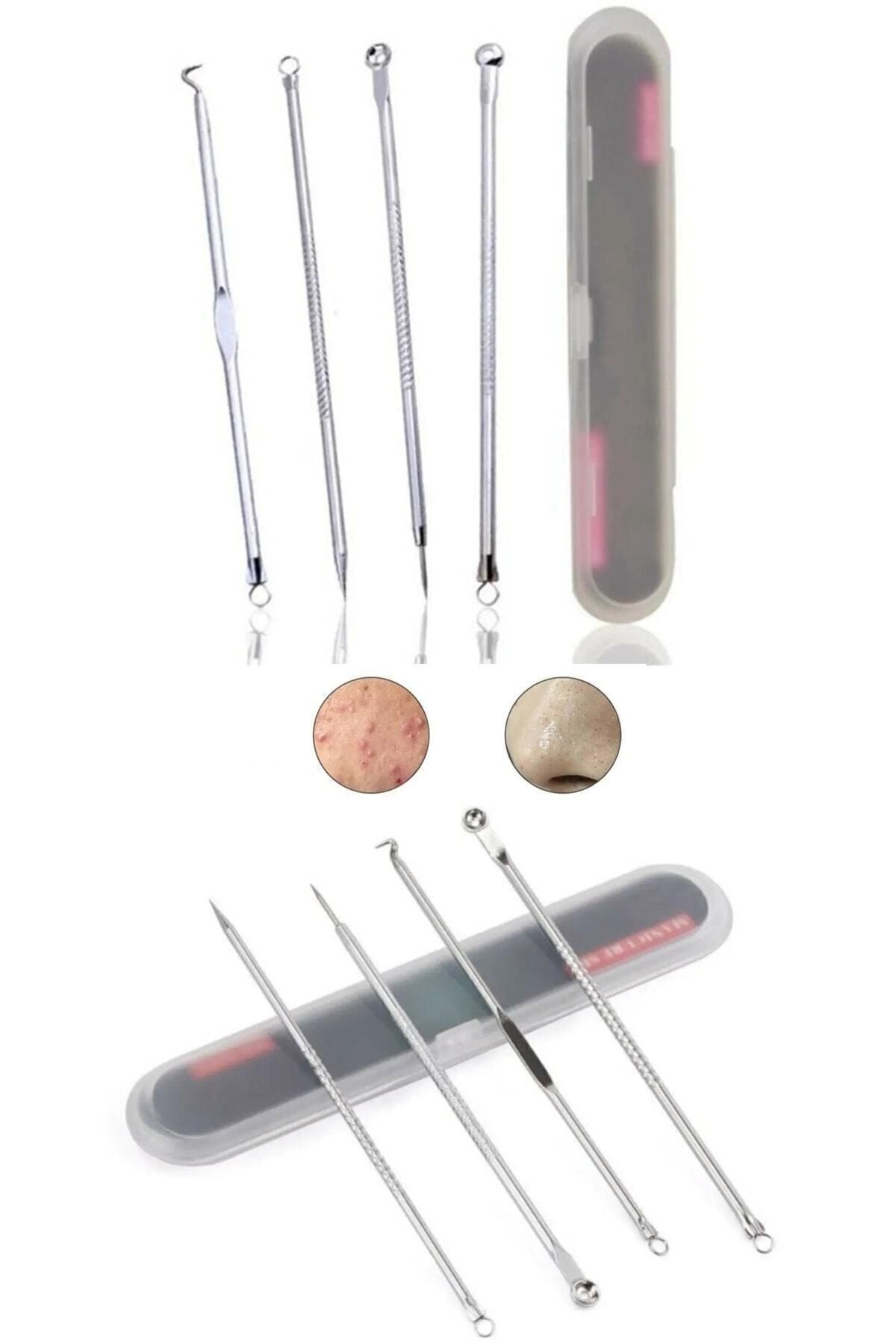LastingBeauty 4 Parça Kutulu Paslanmaz Çelik Sivilce Akne Siyah Nokta Temizleme Komedon Aleti