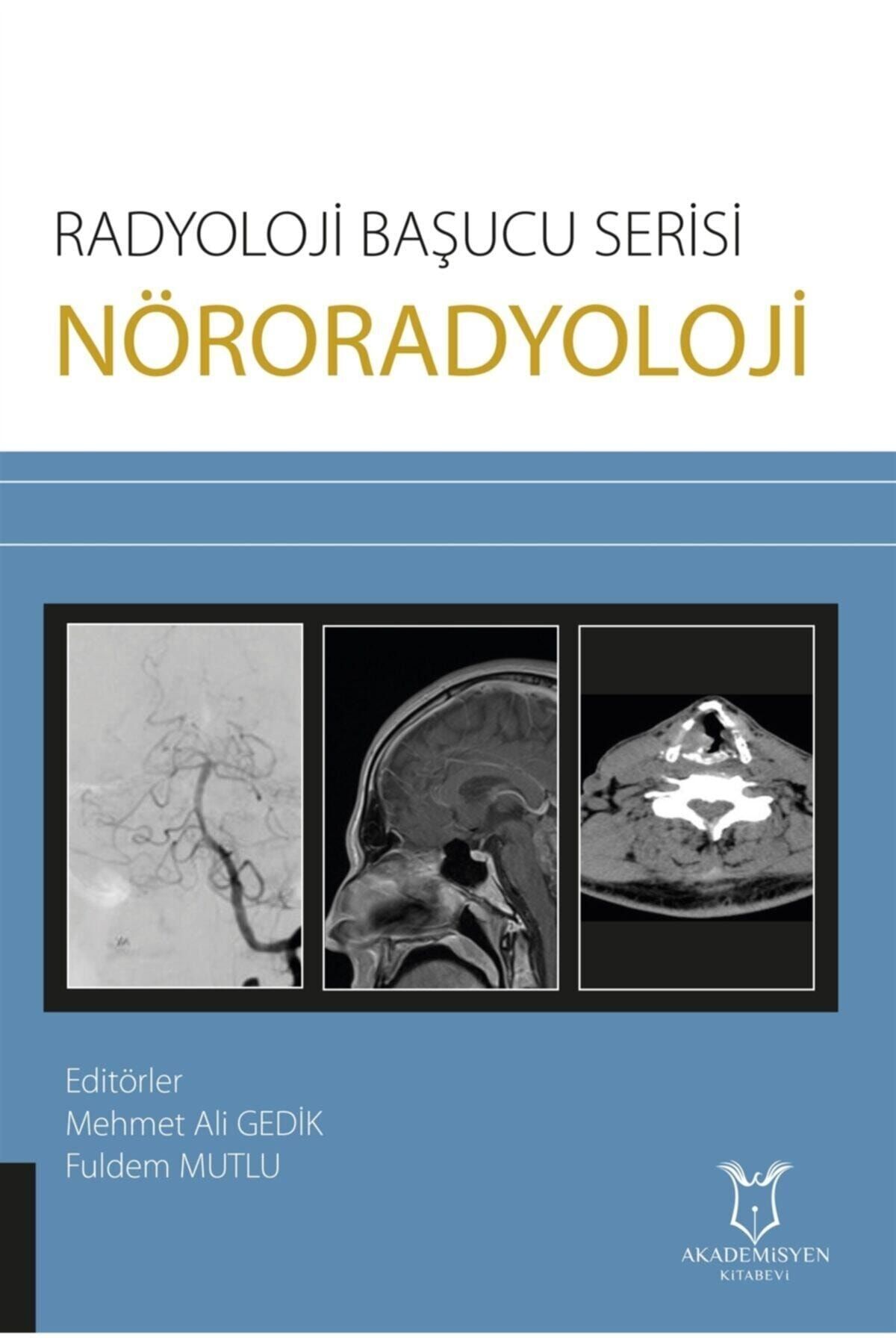 Akademisyen Kitabevi Nöroradyoloji - Radyoloji Başucu Serisi - Mehmet Ali Gedik 9786257275323