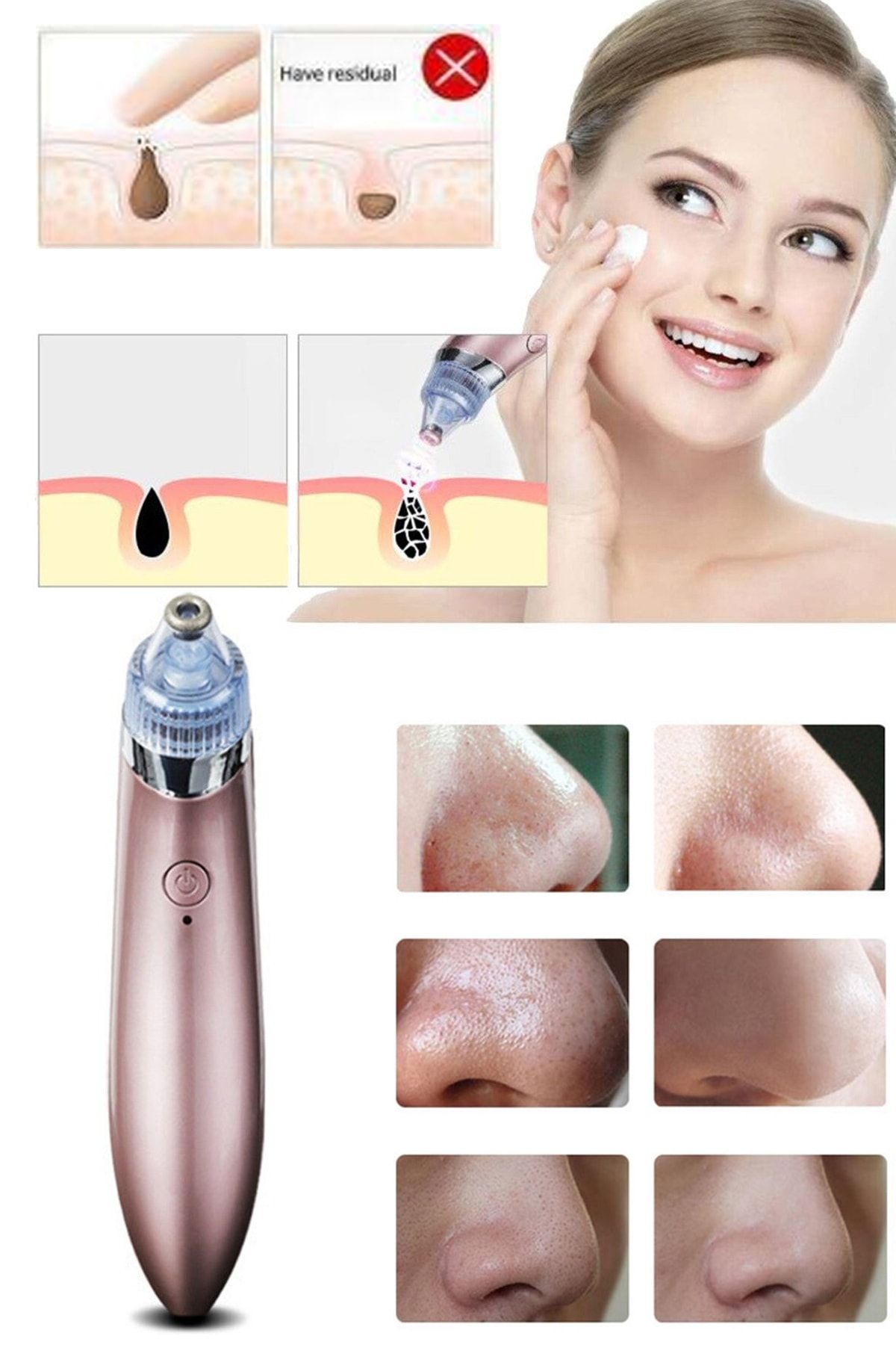 xolo 4 in 1 Vakumlu Şarjlı Yüz Temizleme + Dermaroller 1,5 mm + Jade Roller Siyah Yeşim Taşı 2