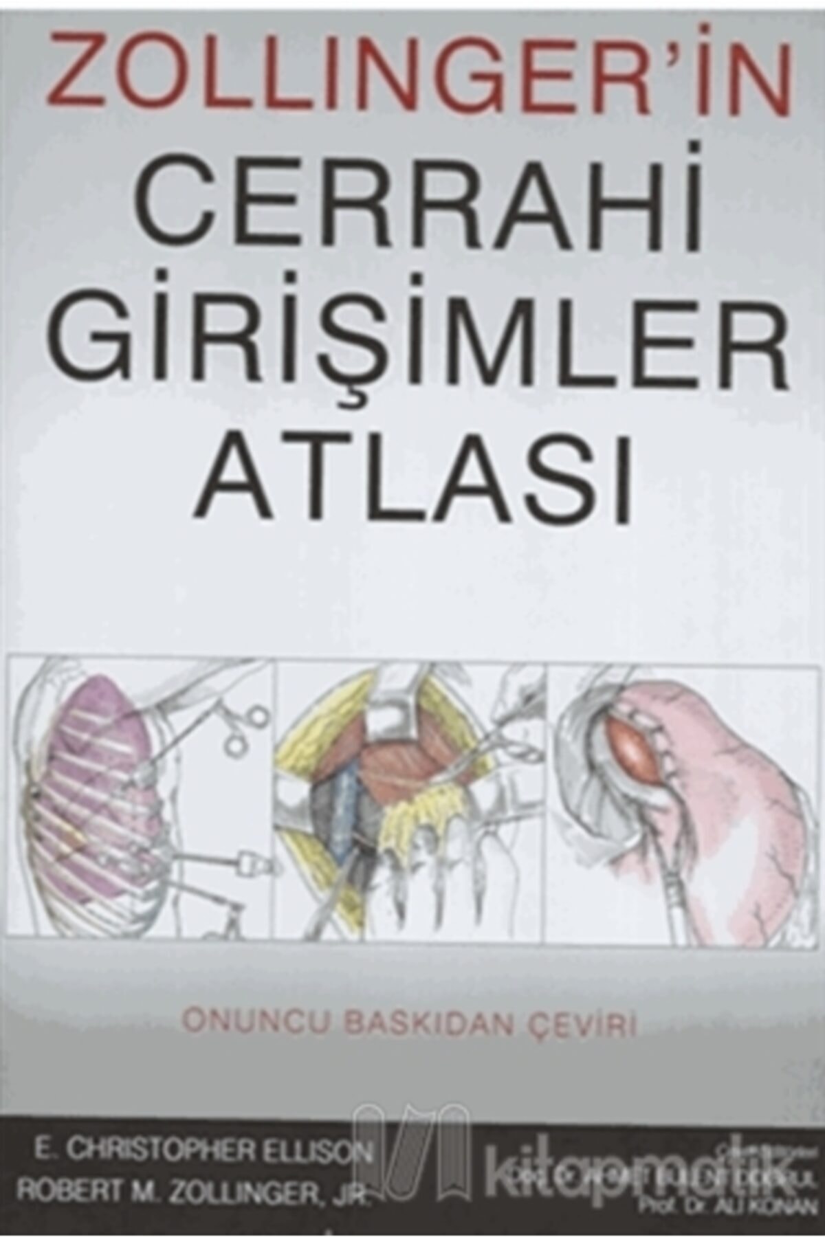 Palme Yayınevi Zollinger'in Cerrahi Girişimler Atlası