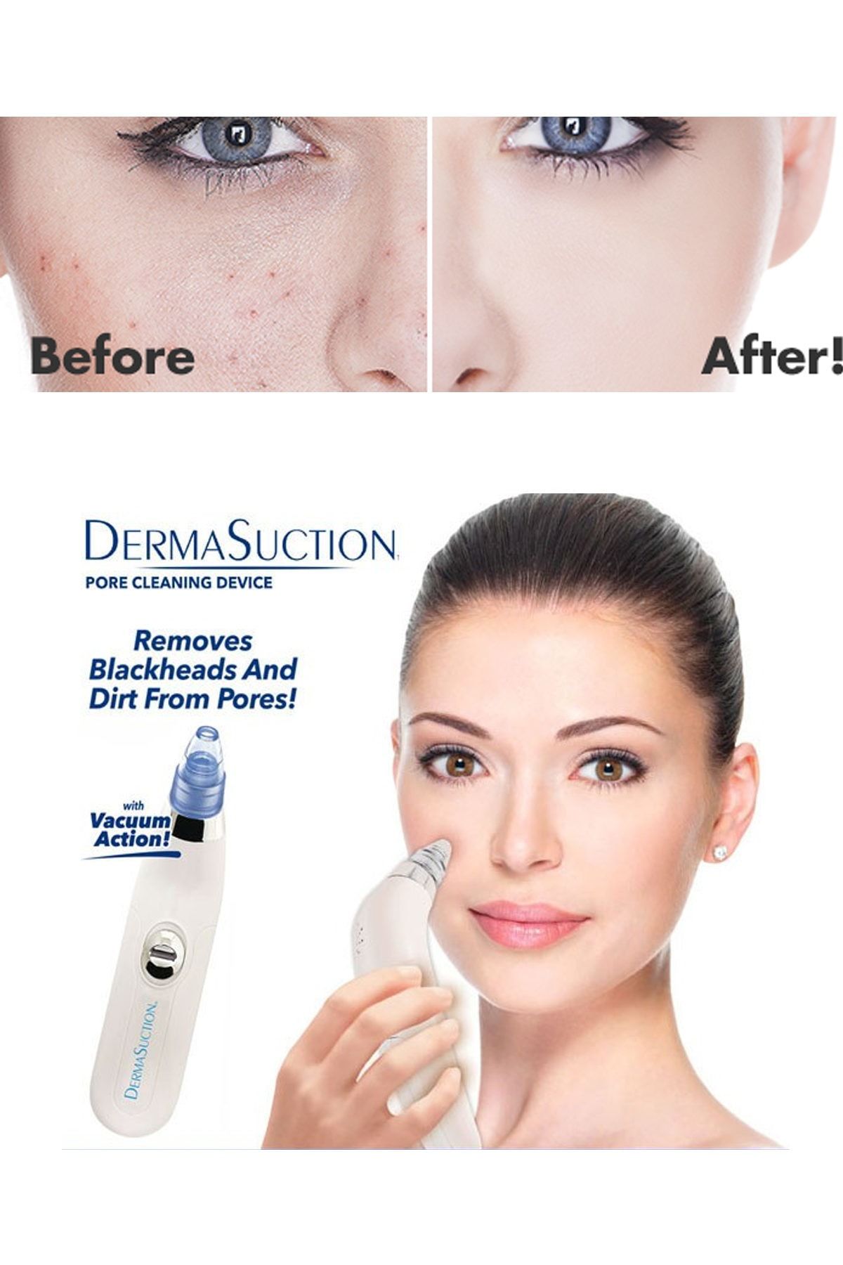 xolo derma suction 40 kpa vakumlu siyah nokta ve yuz temizleme cihazi fiyati yorumlari trendyol