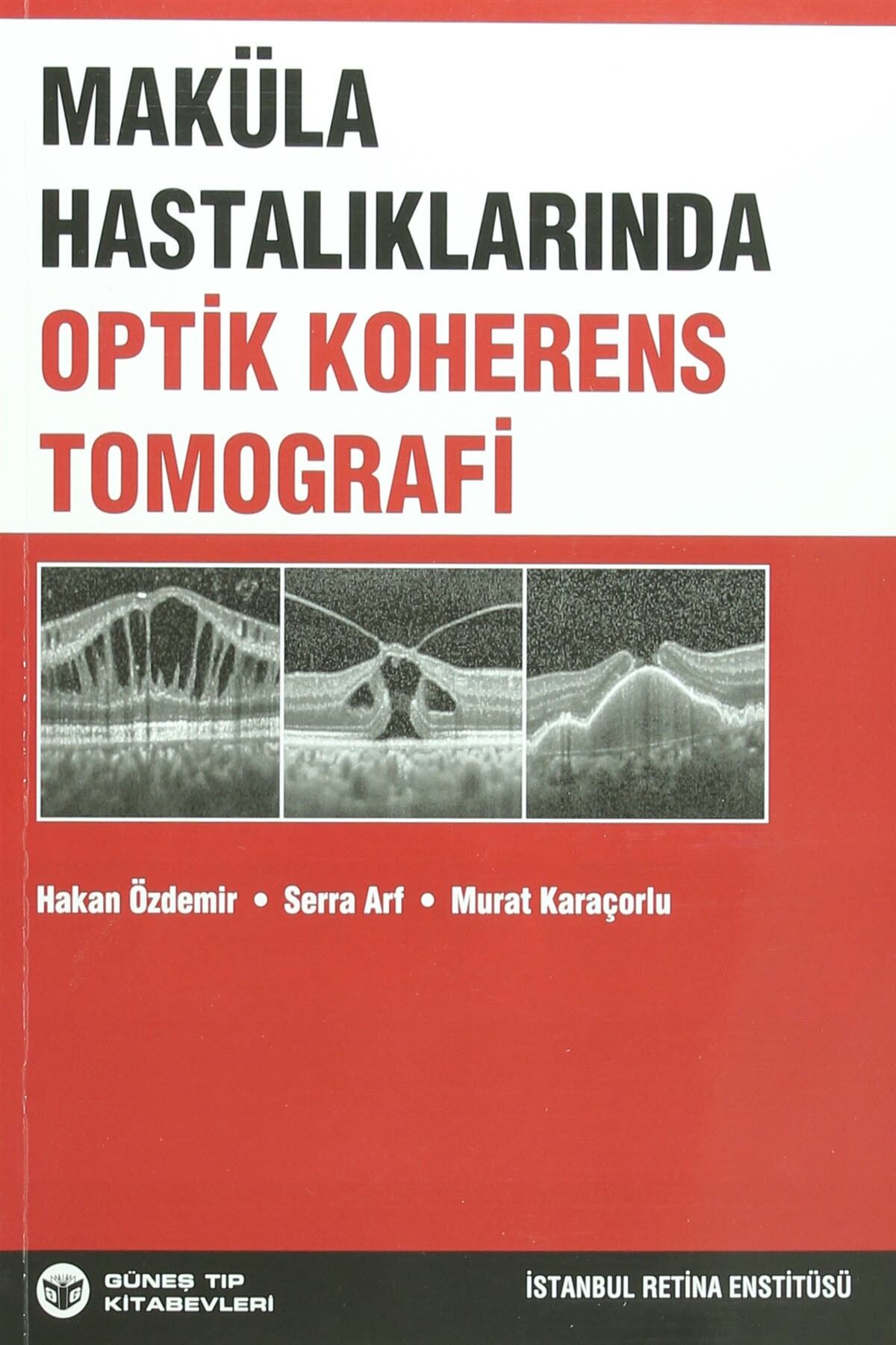 Güneş Tıp Kitabevi Maküla Hastalıklarında Optik Koherens Tomografi