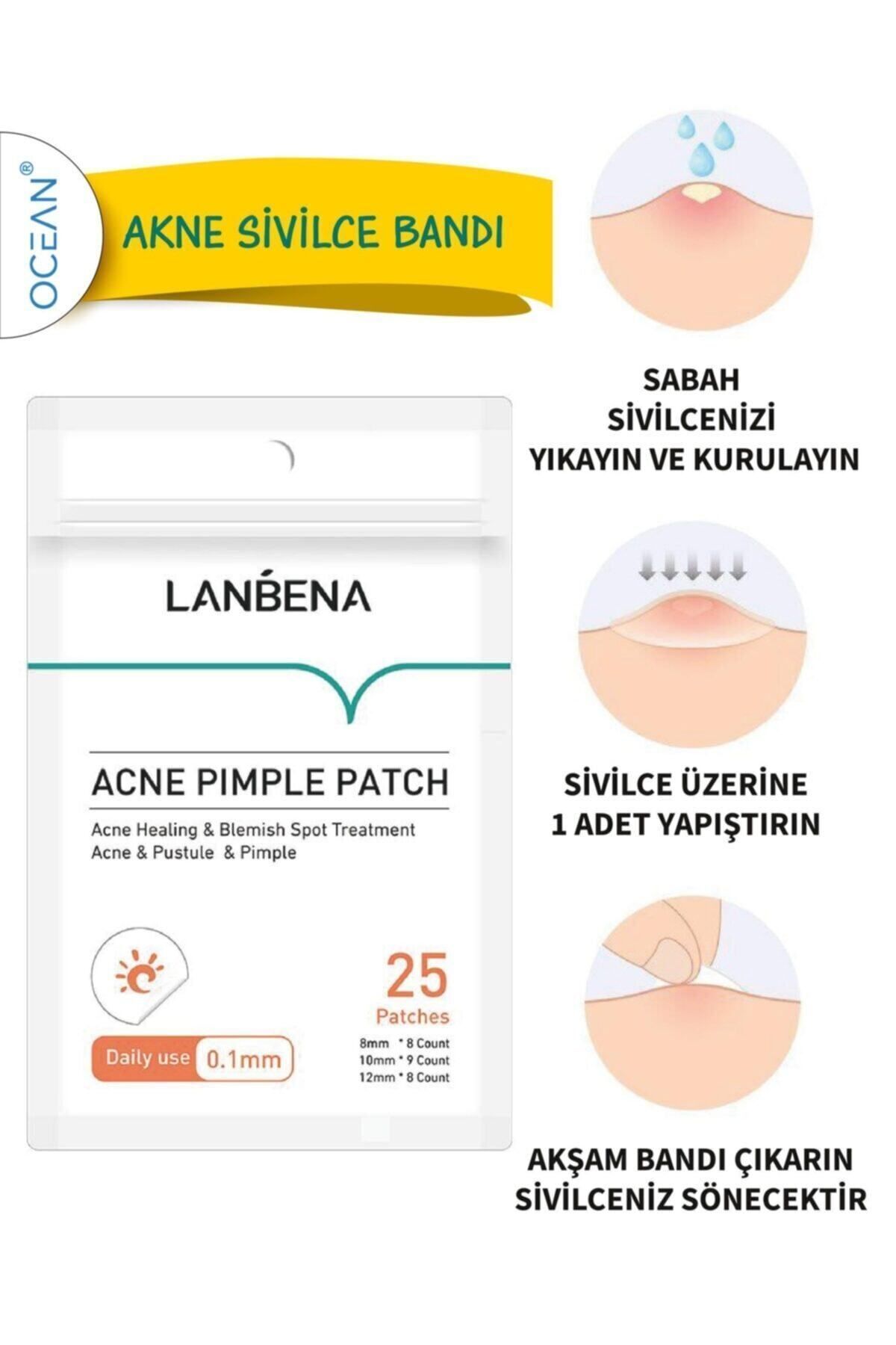 Lanbena Akne Sivilce Bandı (gündüz)